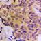 CDK5 Regulatory Subunit Associated Protein 3 antibody, orb224128, Biorbyt, Immunohistochemistry paraffin image 