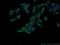 Threonine--tRNA ligase antibody, 24635-1-AP, Proteintech Group, Immunofluorescence image 