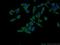 Threonyl-TRNA Synthetase Like 2 antibody, 24635-1-AP, Proteintech Group, Immunofluorescence image 