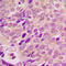 Proliferation And Apoptosis Adaptor Protein 15 antibody, LS-C368454, Lifespan Biosciences, Immunohistochemistry paraffin image 