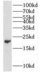 Potassium Voltage-Gated Channel Subfamily E Regulatory Subunit 1 antibody, FNab04482, FineTest, Western Blot image 