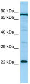 Prostaglandin E Synthase 2 antibody, TA337709, Origene, Western Blot image 