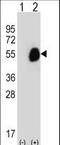 Glutaryl-CoA Dehydrogenase antibody, LS-C166409, Lifespan Biosciences, Western Blot image 