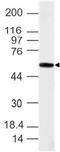 T antibody, A02161, Boster Biological Technology, Western Blot image 