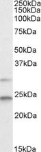 Mitotic Arrest Deficient 2 Like 1 antibody, EB05612, Everest Biotech, Western Blot image 