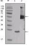 SRC Proto-Oncogene, Non-Receptor Tyrosine Kinase antibody, NBP1-47547, Novus Biologicals, Western Blot image 