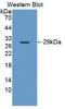 Amyloid P Component, Serum antibody, LS-C663198, Lifespan Biosciences, Western Blot image 