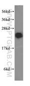RAB2A, Member RAS Oncogene Family antibody, 15420-1-AP, Proteintech Group, Western Blot image 