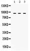 Transporter 1, ATP Binding Cassette Subfamily B Member antibody, PA5-80094, Invitrogen Antibodies, Western Blot image 