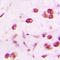 Distal-Less Homeobox 5 antibody, LS-C352118, Lifespan Biosciences, Immunohistochemistry paraffin image 