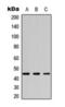 Casein Kinase 2 Alpha 1 antibody, orb393260, Biorbyt, Western Blot image 