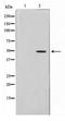 Glycerol-3-Phosphate Acyltransferase 3 antibody, TA347619, Origene, Western Blot image 