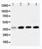 Insulin Like Growth Factor Binding Protein 3 antibody, LS-C312655, Lifespan Biosciences, Western Blot image 