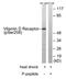 Vitamin D Receptor antibody, GTX52380, GeneTex, Western Blot image 