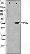 Serum/Glucocorticoid Regulated Kinase 1 antibody, orb106291, Biorbyt, Western Blot image 