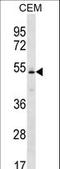 Potassium Voltage-Gated Channel Subfamily J Member 4 antibody, LS-C165434, Lifespan Biosciences, Western Blot image 