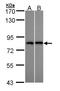 DEAD-Box Helicase 3 X-Linked antibody, LS-C186094, Lifespan Biosciences, Western Blot image 