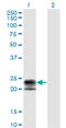 TNF Receptor Superfamily Member 17 antibody, LS-C196740, Lifespan Biosciences, Western Blot image 