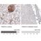 Thrombospondin Type 1 Domain Containing 7A antibody, NBP2-61638, Novus Biologicals, Immunohistochemistry paraffin image 