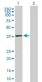 Actin Related Protein T2 antibody, H00140625-D01P, Novus Biologicals, Western Blot image 