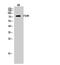 Follicle Stimulating Hormone Receptor antibody, PA5-50963, Invitrogen Antibodies, Western Blot image 