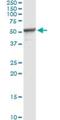 Protein Phosphatase, Mg2+/Mn2+ Dependent 1F antibody, H00009647-M02, Novus Biologicals, Immunoprecipitation image 