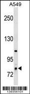 Ring Finger Protein 6 antibody, 60-356, ProSci, Western Blot image 