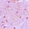 TLE Family Member 4, Transcriptional Corepressor antibody, LS-C352938, Lifespan Biosciences, Immunohistochemistry frozen image 