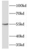 T-Box 22 antibody, FNab08539, FineTest, Western Blot image 