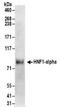 HNF1 Homeobox A antibody, NBP2-32126, Novus Biologicals, Western Blot image 