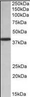 Poly(RC) Binding Protein 1 antibody, orb95480, Biorbyt, Western Blot image 