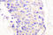 Phospholipase C Gamma 1 antibody, LS-C176572, Lifespan Biosciences, Immunohistochemistry paraffin image 