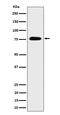 CREB-regulated transcription coactivator 3 antibody, M04568, Boster Biological Technology, Western Blot image 