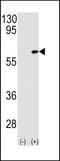 TGF-Beta Activated Kinase 1 (MAP3K7) Binding Protein 1 antibody, LS-C164003, Lifespan Biosciences, Western Blot image 