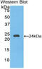 Cadherin 5 antibody, MBS2014304, MyBioSource, Western Blot image 