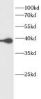 GRB2 Related Adaptor Protein 2 antibody, FNab03635, FineTest, Western Blot image 