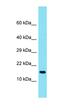 Transmembrane Protein 190 antibody, orb326875, Biorbyt, Western Blot image 