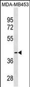 Kynurenine Aminotransferase 1 antibody, PA5-49033, Invitrogen Antibodies, Western Blot image 