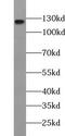 WD Repeat Domain 6 antibody, FNab09499, FineTest, Western Blot image 