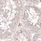 Leucine Rich Repeat Containing 15 antibody, PA5-57298, Invitrogen Antibodies, Immunohistochemistry frozen image 
