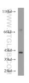 Protein Phosphatase, Mg2+/Mn2+ Dependent 1L antibody, 18203-1-AP, Proteintech Group, Western Blot image 