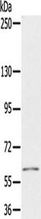 Pyruvate Dehyrogenase Phosphatase Catalytic Subunit 1 antibody, TA350298, Origene, Western Blot image 