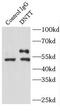 DNA Nucleotidylexotransferase antibody, FNab02489, FineTest, Immunoprecipitation image 