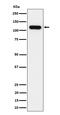 Nucleolar And Coiled-Body Phosphoprotein 1 antibody, M04778, Boster Biological Technology, Western Blot image 