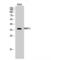 BCL2 Interacting Protein 2 antibody, LS-C382299, Lifespan Biosciences, Western Blot image 