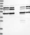 Branched Chain Keto Acid Dehydrogenase E1 Subunit Alpha antibody, NBP1-81022, Novus Biologicals, Western Blot image 