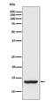 Tax1 Binding Protein 3 antibody, M05588, Boster Biological Technology, Western Blot image 