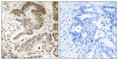 Phosphoinositide-3-Kinase Regulatory Subunit 5 antibody, abx014714, Abbexa, Western Blot image 