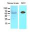 Dishevelled Binding Antagonist Of Beta Catenin 3 antibody, NBP1-19052, Novus Biologicals, Western Blot image 