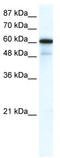 Gamma-Aminobutyric Acid Type A Receptor Alpha1 Subunit antibody, TA338499, Origene, Western Blot image 
